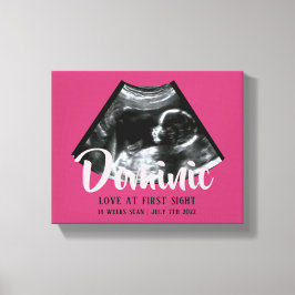 Sonogram Keepake Baby Ultrasound Canvas Print Leinwanddruck