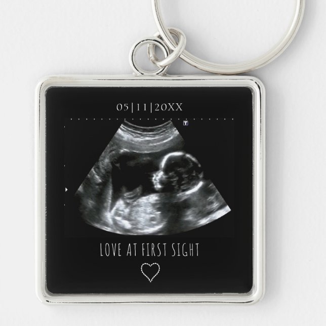 Sonogram Picture Foto Geschenk Baby Ultrasound Bla Schlüsselanhänger (Vorne)