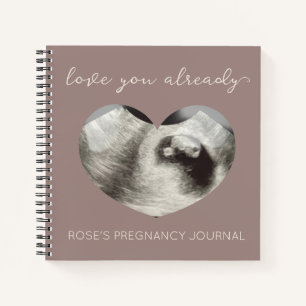 Sonogramme cardiaque simple Journal de grossesse