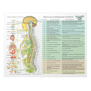 Spanische ANS Subluxation Effects reißen Pad Notizblock