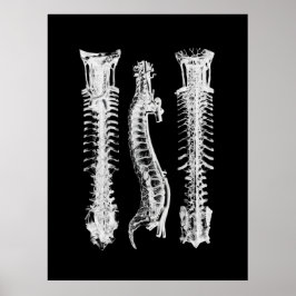 Spine Anatomie Art Poster