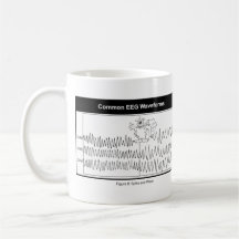 Spitzen-und Wellen-Kaffee-Tasse