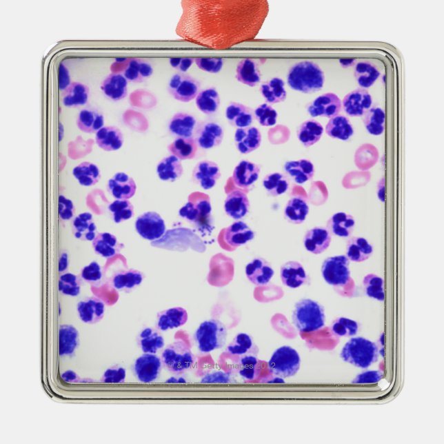 Staphyloinfektion Ornament Aus Metall (Vorne)