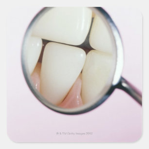 Sticker Carré Gros plan des dents reflété dans le miroir dentair