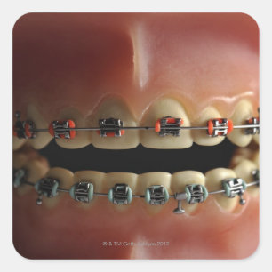 Sticker Carré Modèle dentaire et bracelets de dents