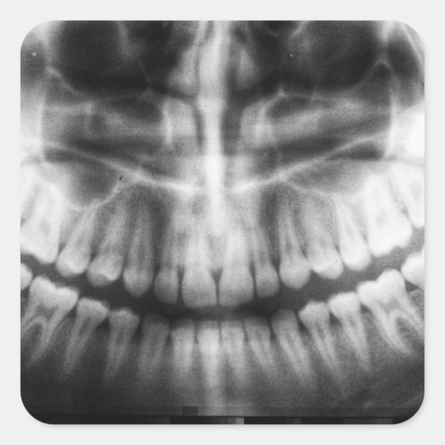 Sticker Carré X-Ray Teeth Bouche sourire noir et blanc (Devant)