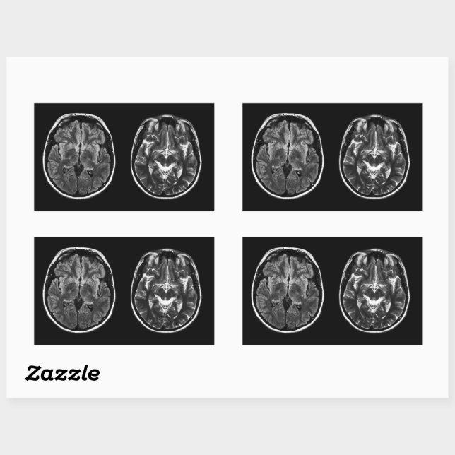 Sticker Rectangulaire Analyse Mri du cerveau (Feuille)