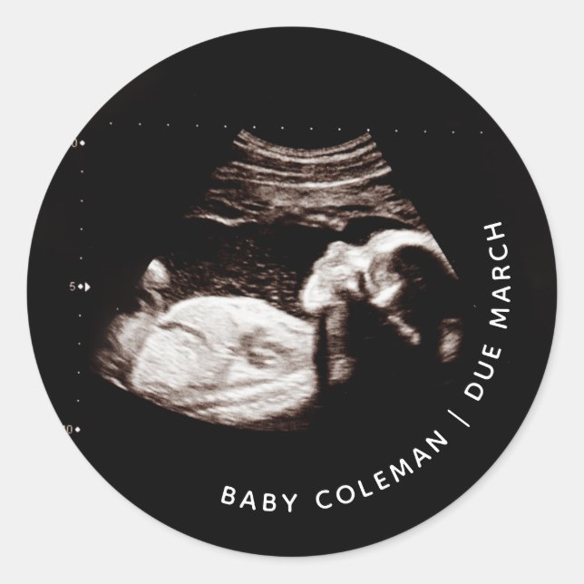 Sticker Rond Faire-part de grossesse Sonogramme bébé Photo (Devant)