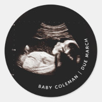 Faire-part de grossesse Sonogramme bébé Photo