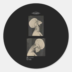 Sticker Rond Paramore coupé headbanger radiographie médecins 
