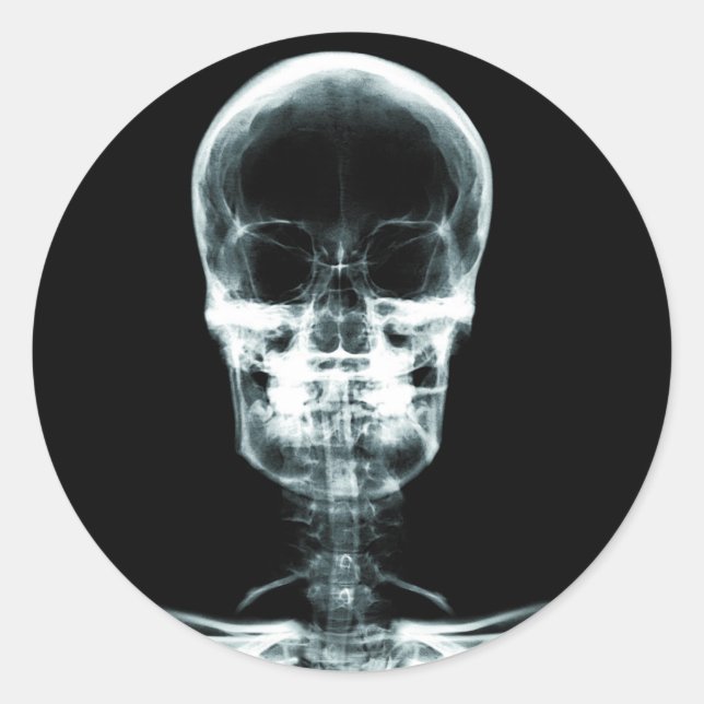 STICKER ROND SKELETON DE VISION X-RAY SKULL - ORIGINAL (Devant)