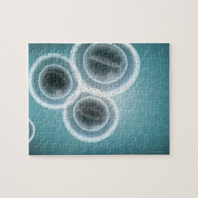 Struktur der MRSA (Horizontal)