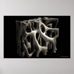 Struktur eines Knochens mit Osteoporose Poster