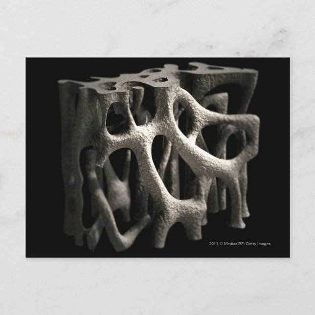 Struktur eines Knochens mit Osteoporose Postkarte (Vorderseite)