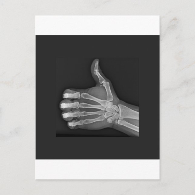 Stupf Postkarte (Vorderseite)