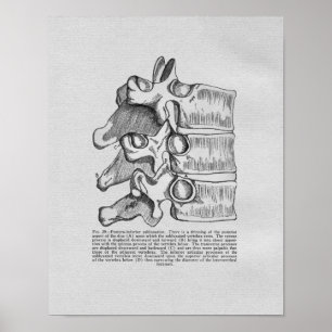 Subluxe Vertébrale Chiropratique Impression Vintag