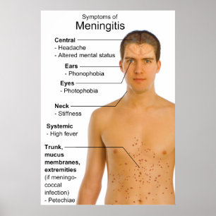 Symptomdiagramm der Entzündungskrankheit Meningiti Poster