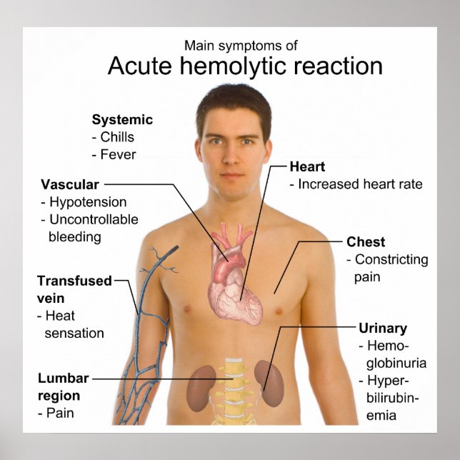 Symptome einer akuten hämolytischen Transfusionsre Poster (Vorne)