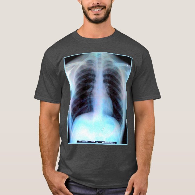 T-shirt Chemise de rayon X de cage thoracique (Devant)