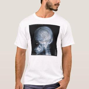 T-shirt Étude coque : Joueur Roto Tom - Drums Roto Tom