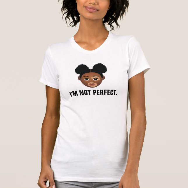T-shirt #Proud2BNaturalMe Vitiligo parfaitement imparfait (Devant)