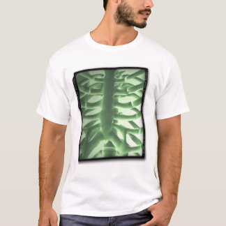 T-shirt Radiographie de la poitrine portative d'ACWE