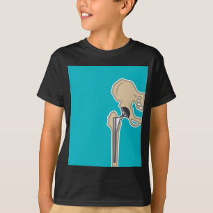 T-shirt Remplacement d'articulation de la hanche