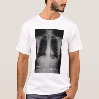 T-shirt “Retro VHS X-Ray” Old-school chest X-ray with VHS 