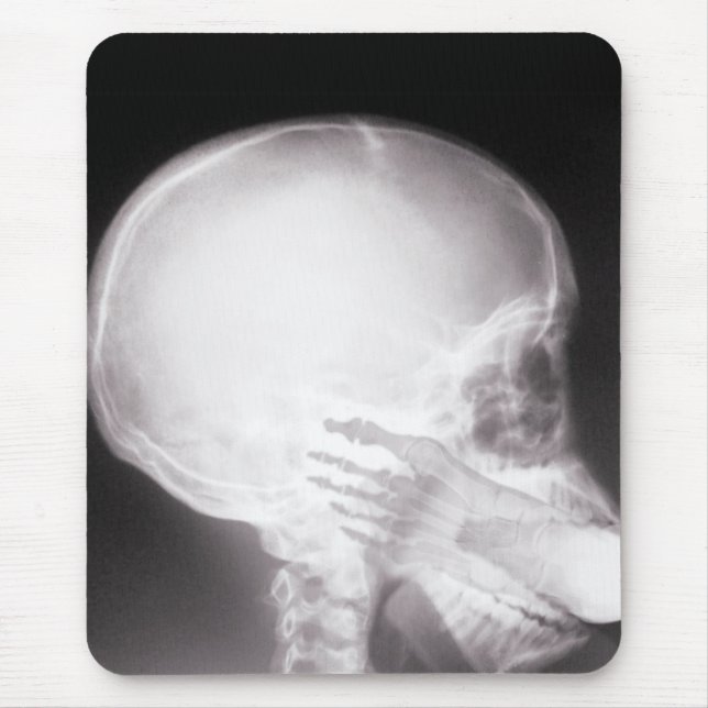 Tapis De Souris Foot à Mouth X-Ray (Devant)