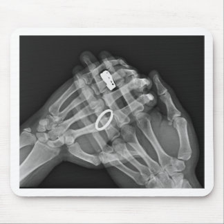 Tapis De Souris Participation de main