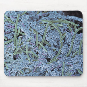 Tapis De Souris Plaque dentaire, électron à balayage coloré