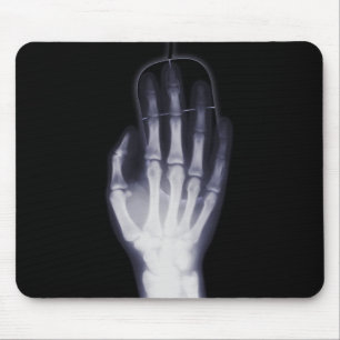 Tapis De Souris Radiographie à main amusante pour les addicteurs I