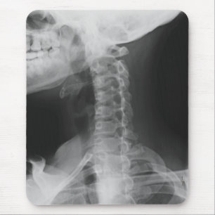 Tapis De Souris Rayon X 2