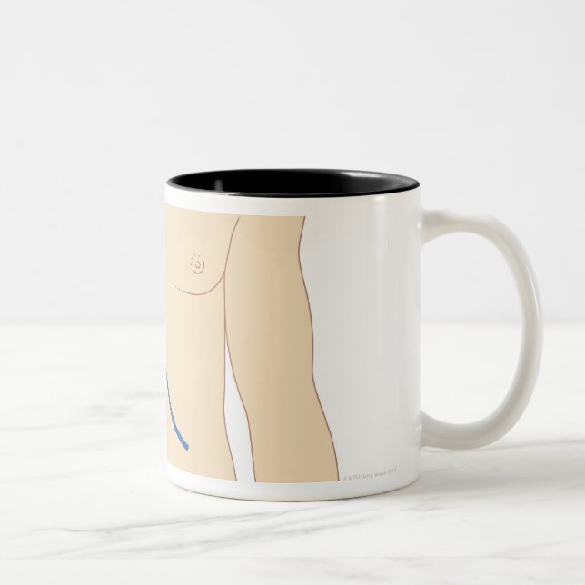 Tasse 2 Couleurs Greffe de foie (Droit)