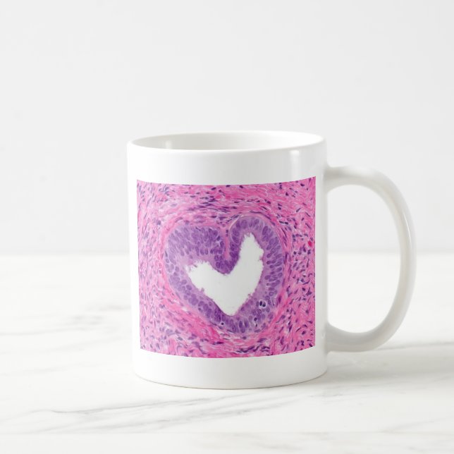 Tasse d'amour d'histologie (Droite)