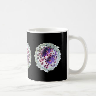 Tasse de café - éosinophilie