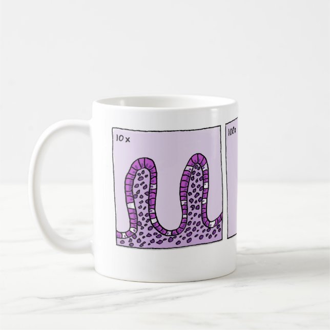 tasse de l'immunohistochimie 1000x (Gauche)