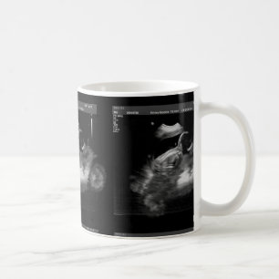 Tasse de sonogramme de moto