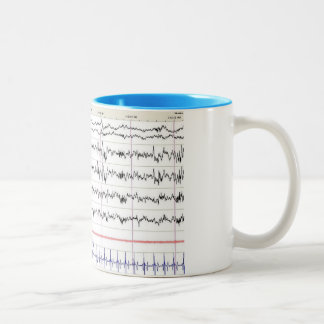 Tasse des Schlaf-EEG - Schlaf der Bühne-2