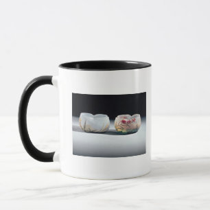 Tasse Deux cuvettes par Daum, Nancy, France