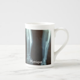 Tasse En Porcelaine Rayon cassé et Ulna Xray "Temps de pause"
