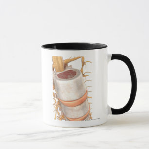Tasse Fermez-vous d'un disque invertebral dans l'épine