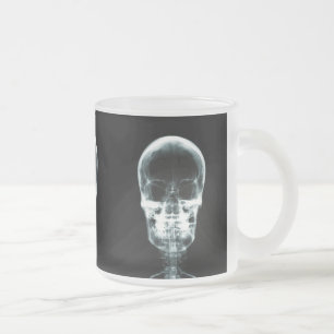 TASSE GIVRÉ CRÂNE SQUELETTIQUE DE VISION DE RAYON X - ORIGINAL