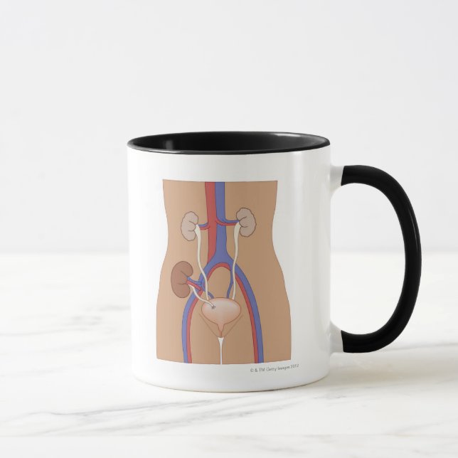 Tasse Greffe de rein (Droite)