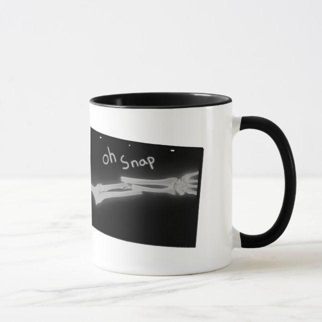 Tasse Oh rupture (Droite)