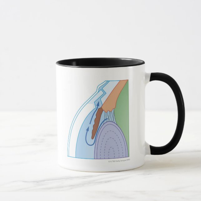 Tasse Procédure de trabéculectomie (Droite)