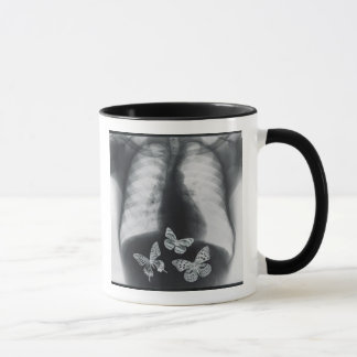Tasse Rayon X des papillons dans l'estomac