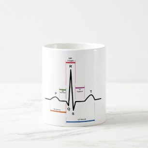 TASSE Sinus Rhythmus EKG-Diagramm