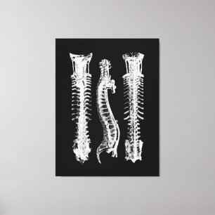 Toile Anatomie de la colonne vertébrale humaine Grande t