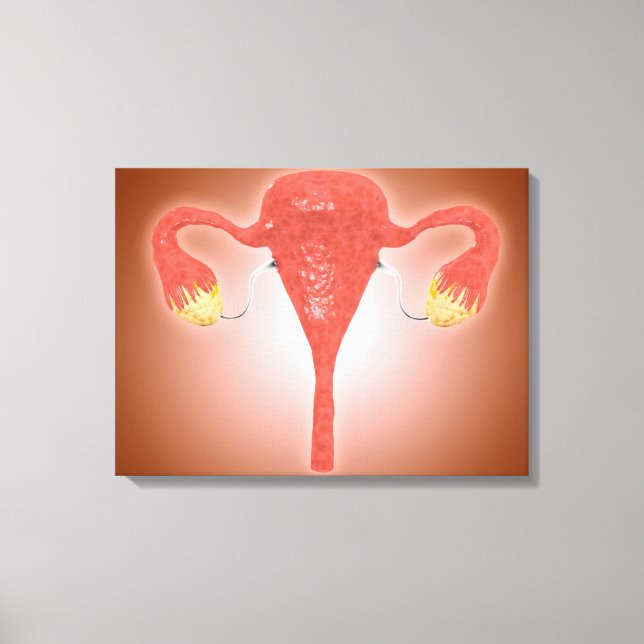 Toile Anatomie De L'Utérus Féminin Avec Ovaires (Recto)
